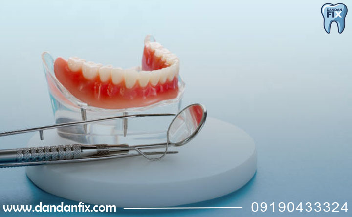 مسواک زدن ایمپلنت