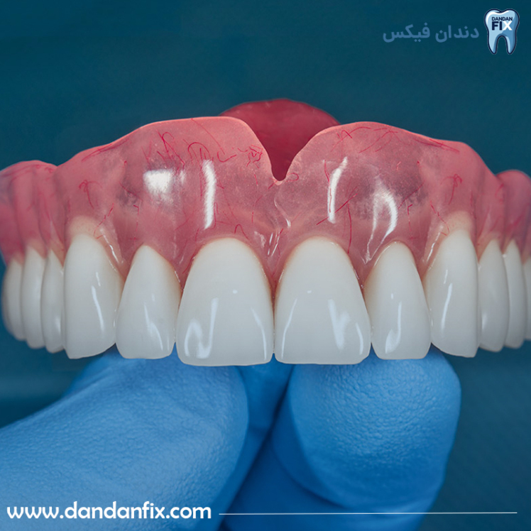 روش های درمان التهاب لثه پس از گذاشتن دندان مصنوعی