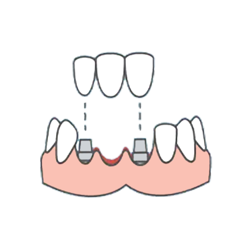 list item image