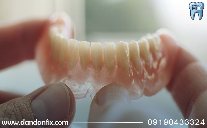 دندان مصنوعی متحرک چه مزایایی دارد؟