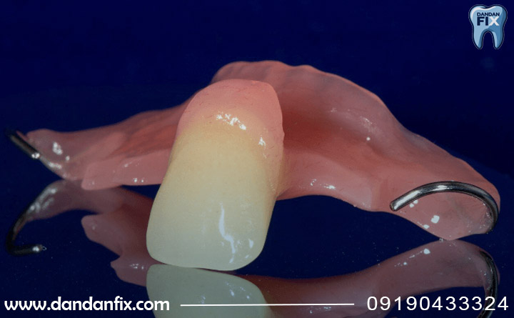 انواع فلیپر دندان