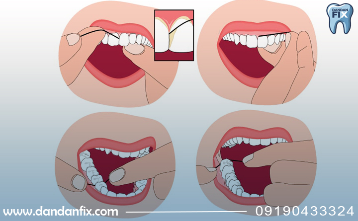 روش صحیح نخ دندان