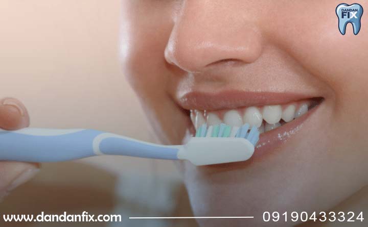 مراقبت از لمینت دندان