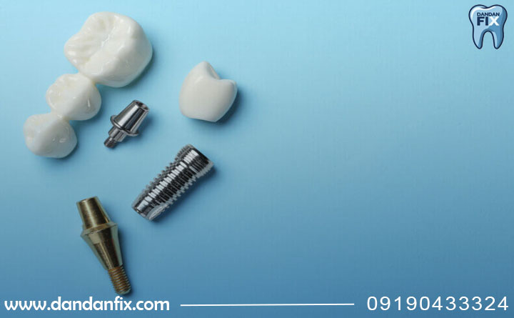 عوارض ایمپلنت دندان