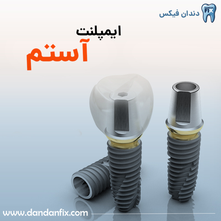 ایمپلنت آستم خوبه؟ بررسی کیفیت و قیمت برند پرطرفدار کره‌ای