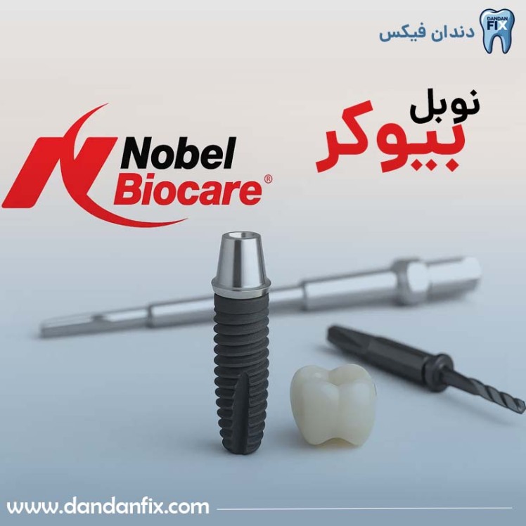 ایمپلنت نوبل بیوکر؛ برند آمریکایی با کیفیت بالا و قیمت بالا!