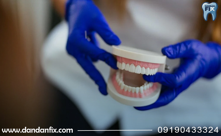 دندان مصنوعی ژله ای بهتره یا اکلریک؟