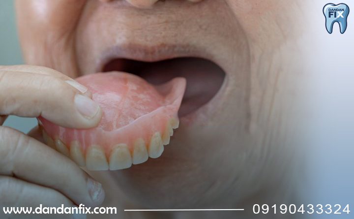 دوام دندان مصنوعی اکلریک