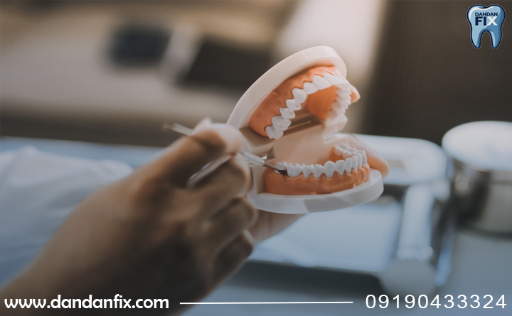 نگهداری دندان مصنوعی تکه ای