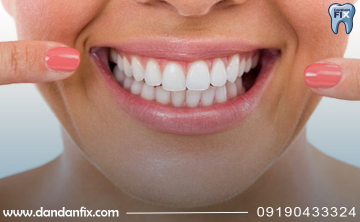 عمر ایمپلنت فوری چقدره؟