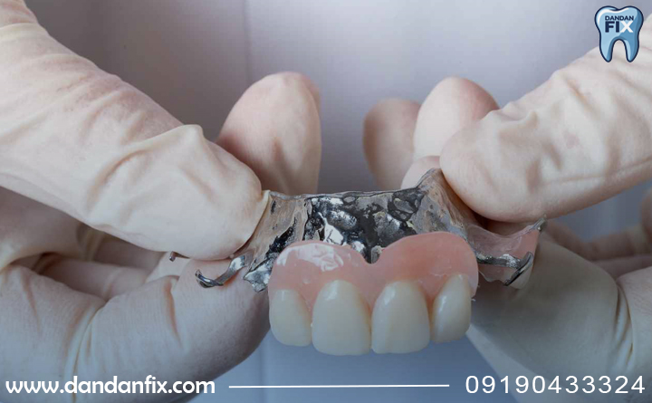 نوع پار سیل