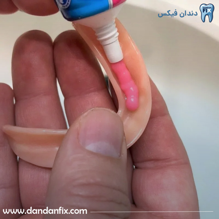 چسب دندان مصنوعی چیست؟