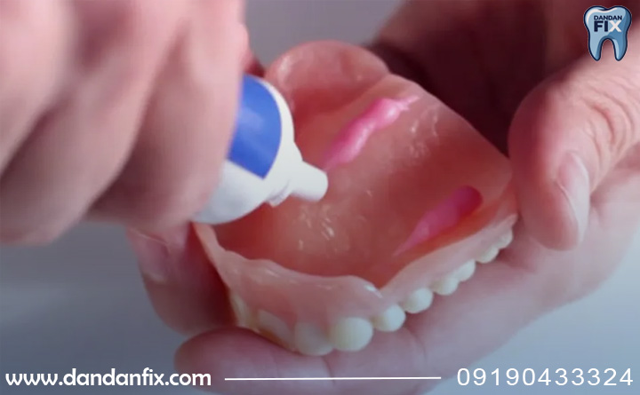 قیمت چسب دندان چنده؟