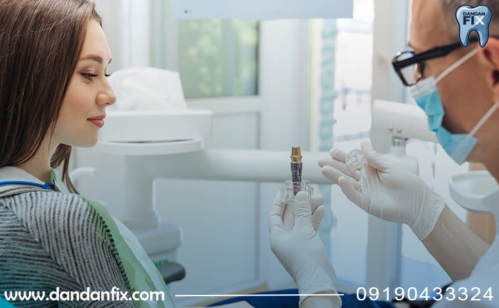 چرا ایمپلنت دندان را عوض میکنند؟