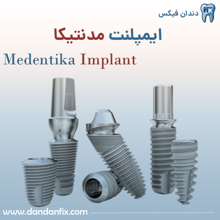 ایمپلنت مدنتیکا؛ گزینه اقتصادی برند اشترومن با کیفیت قابل قبول