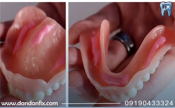 بهترین برندهای چسب دندان مصنوعی