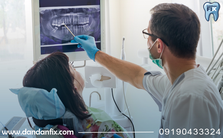 درمان آبسه دندان 