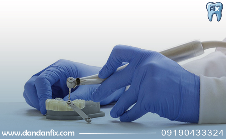 ایمپلنت دیجیتال