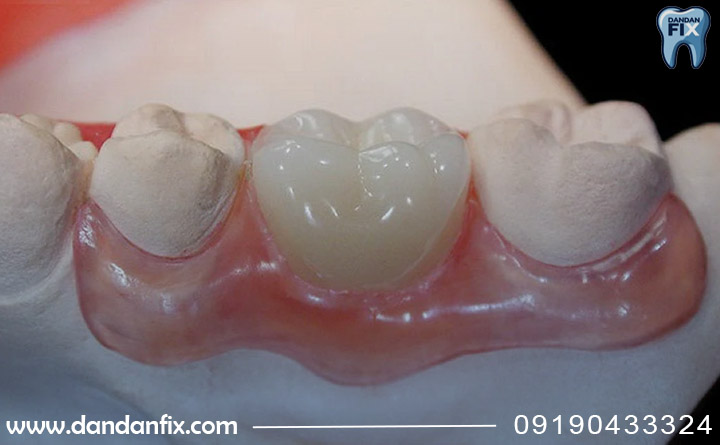 مزیت استفاده از فلیپر