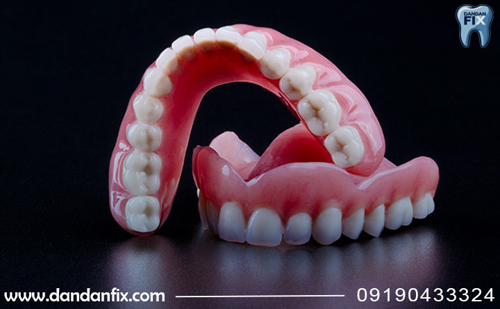 پروتز متحرک چیست؟