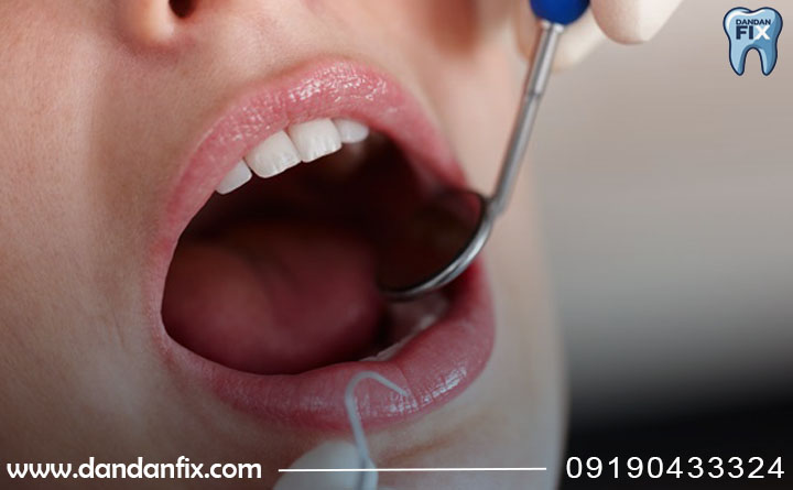 بهترین دندان مصنوعی برای جوانان