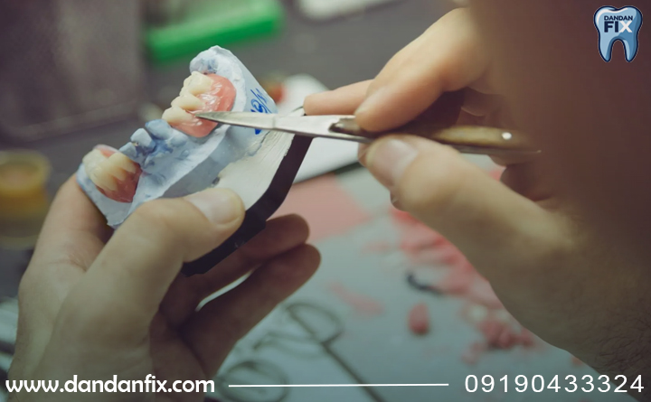 ساخت دندان مصنوعی ژله‌ای