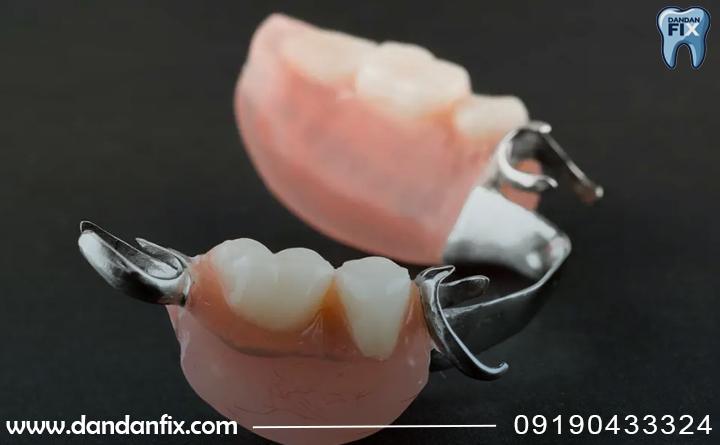 انواع پارسیل