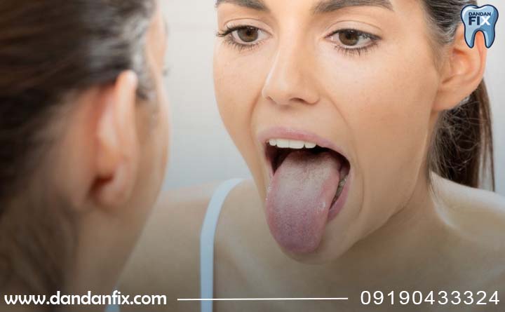 چرا طعم فلز در دهان نگران کننده است؟