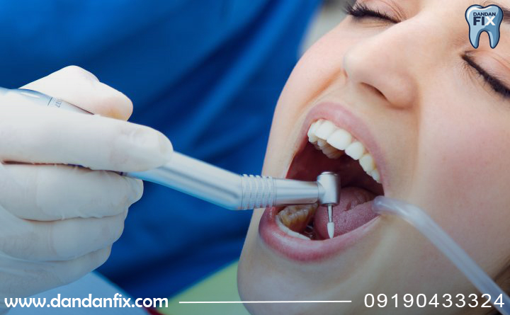 ایمپلنت خراب