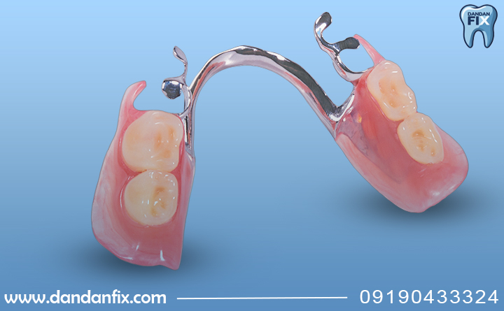 پارسیل چه معایبی داره؟