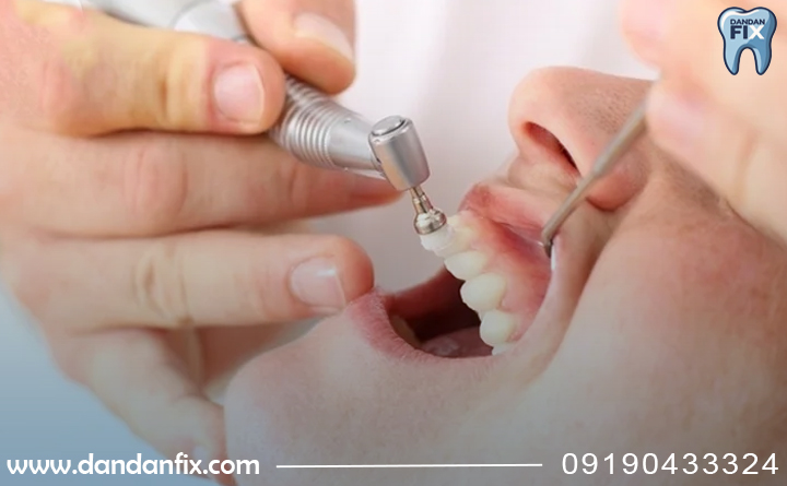 جرم گیری درد داره؟