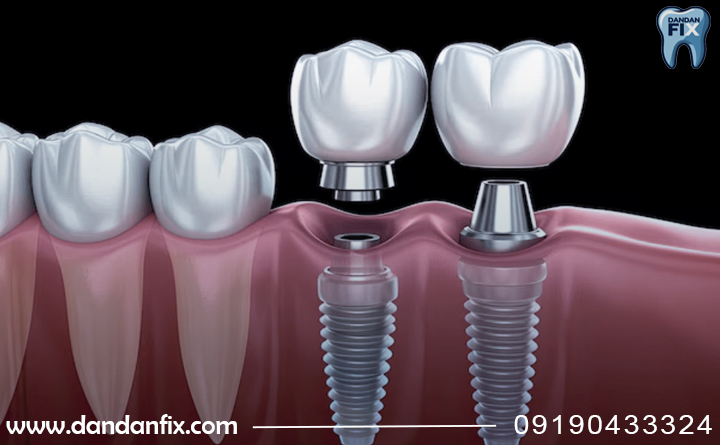 مزایای پانچ