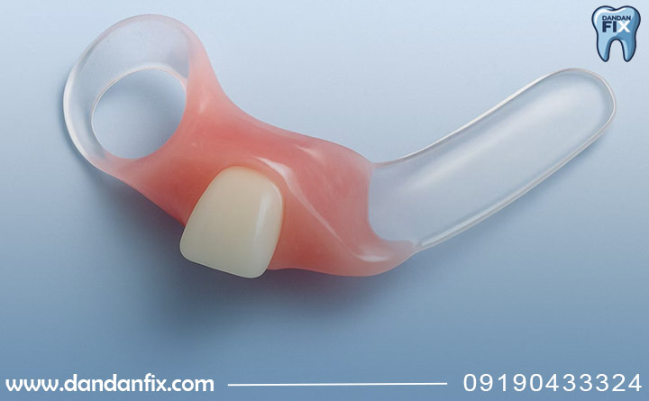 فلیپر دندان جلو