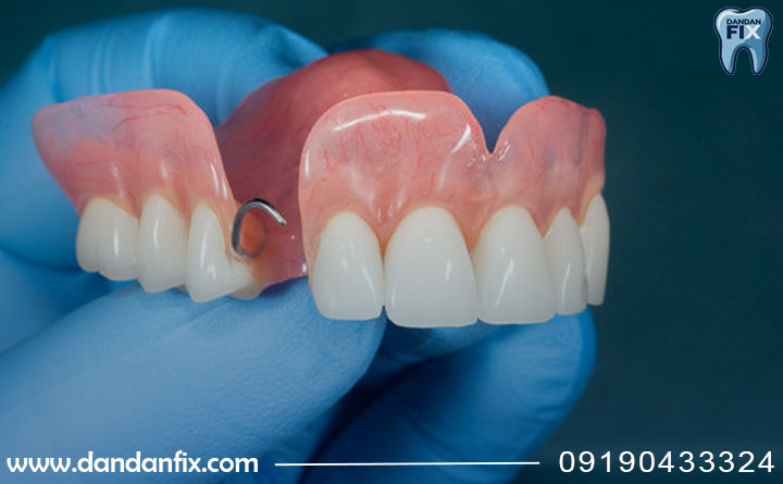 پروتز متحرک پارسیل