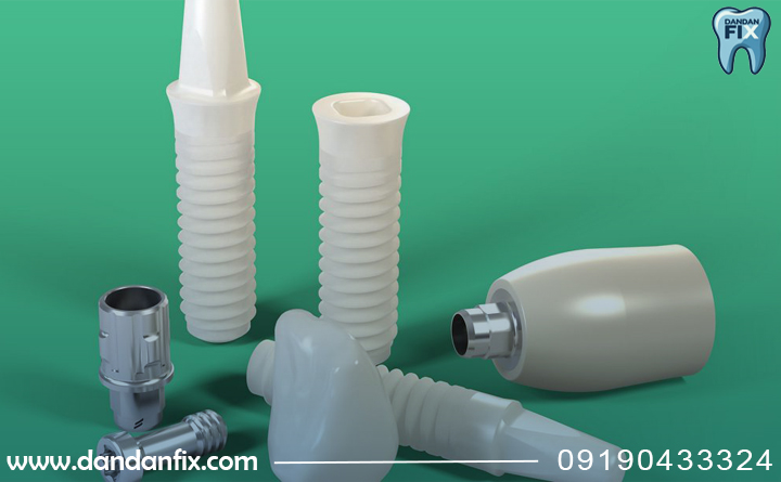 ایمپلنت اشترومن