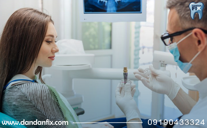 زمان انجام ایمپلنت دندان