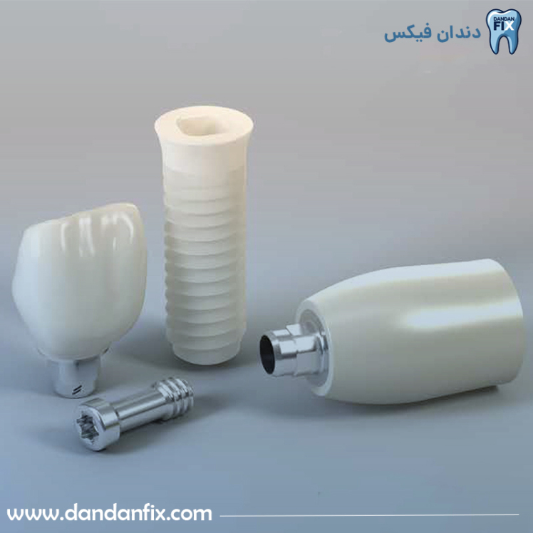 ایمپلنت اشترومن + بررسی ویژگی‌ها و قیمت ایمپلنت اشترومن در ایران