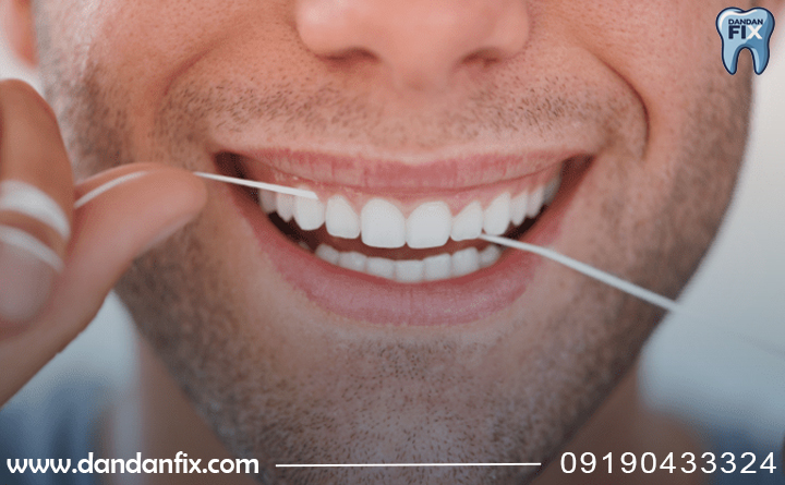 تمیز کردن بریج دندان