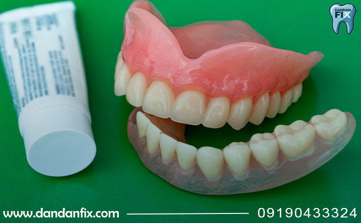 معایب دندان مصنوعی ثابت چسبی
