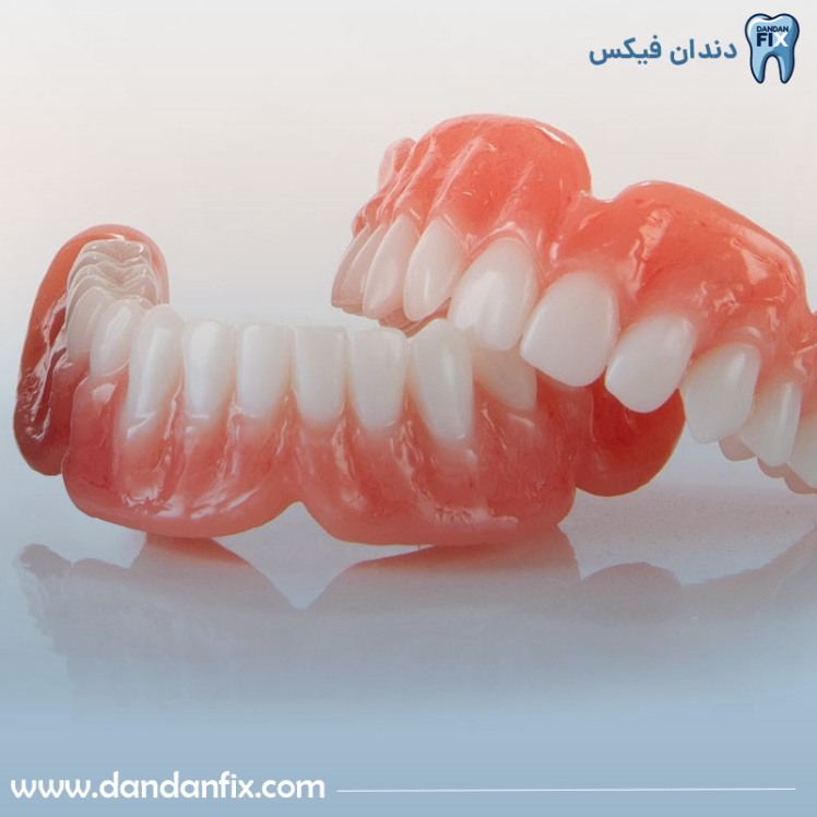 آیا دندان مصنوعی کامپوزیت می‌شود؟ کامپوزیت روی دندان مصنوعی!