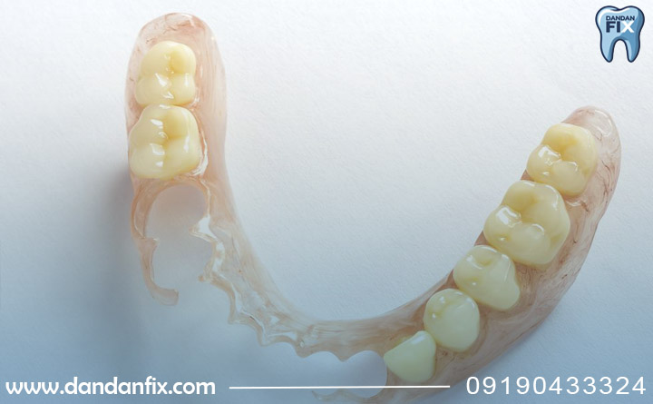 دست دندون متحرک