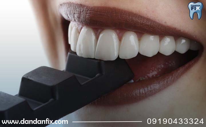 لمینت چندسال دوام دارد؟