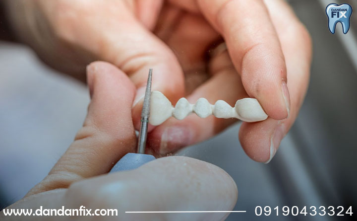 دندان مصنوعی چسبی از چی ساخته میشه؟