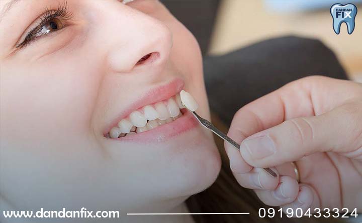 بهترین روش اصلاح لبخند