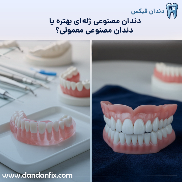 دندان مصنوعی ژله ای بهتر است یا معمولی؟