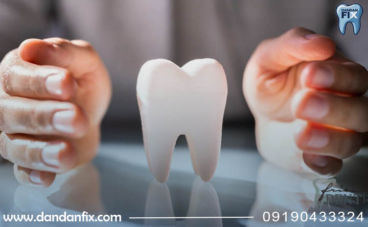 هزینه های ایمپلنت