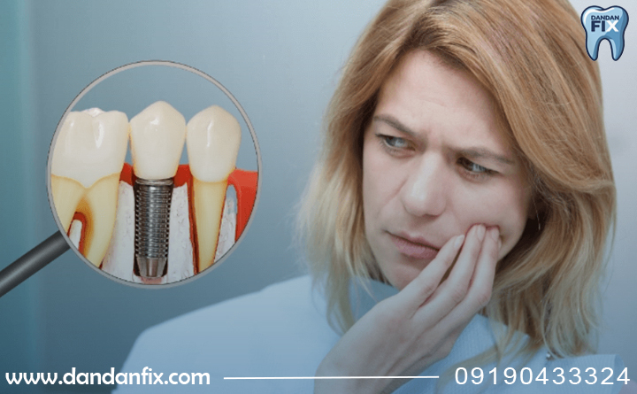 آیا ایمپلنت خراب میشه؟