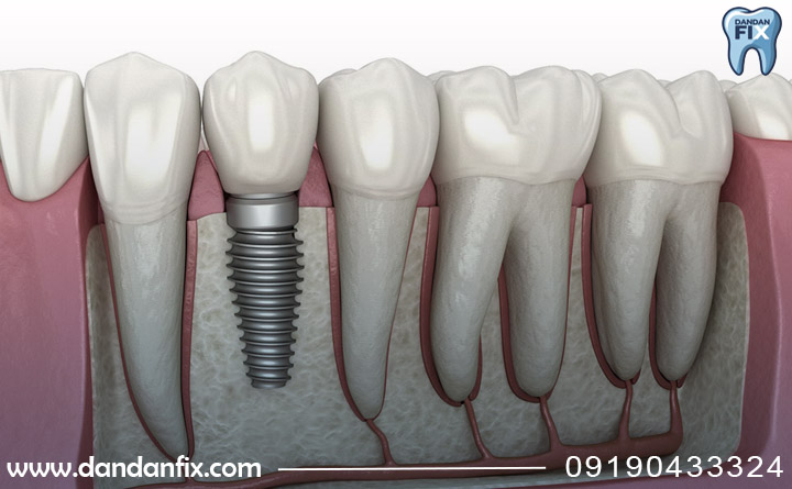 سالم بودن لثه ها