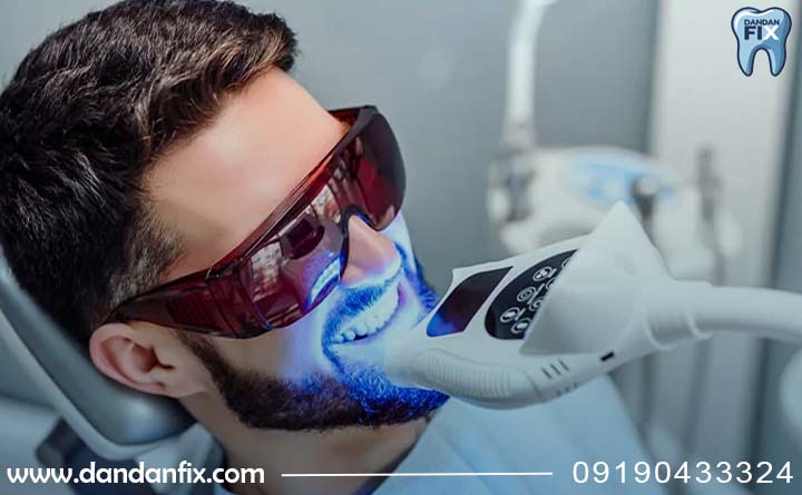 بلیچینگ دندان