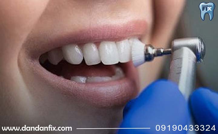 بروساژ چیست